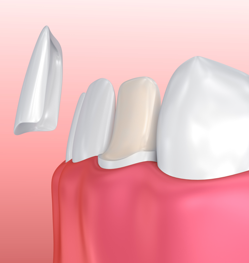 Лечение среднего кариеса зубов цена thumbnail