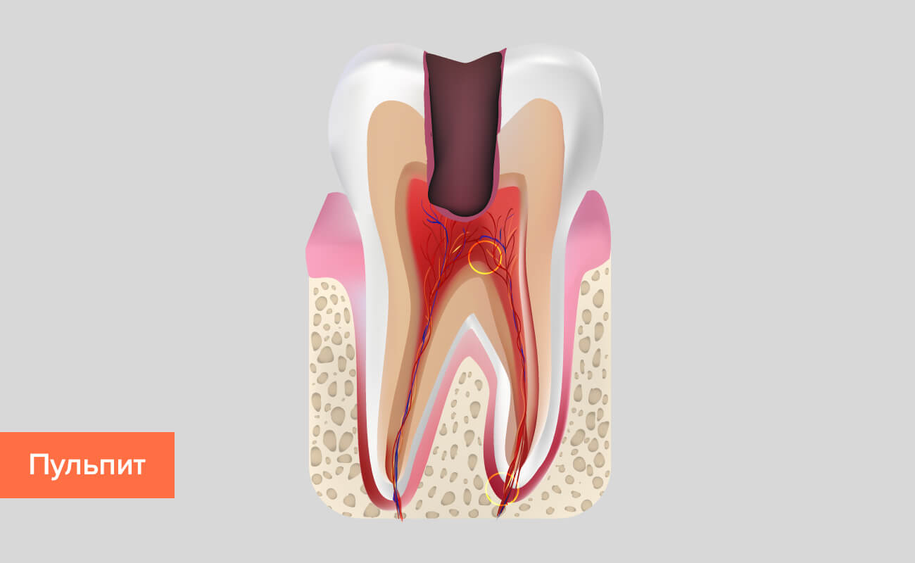 Болезни зубов способы лечения thumbnail