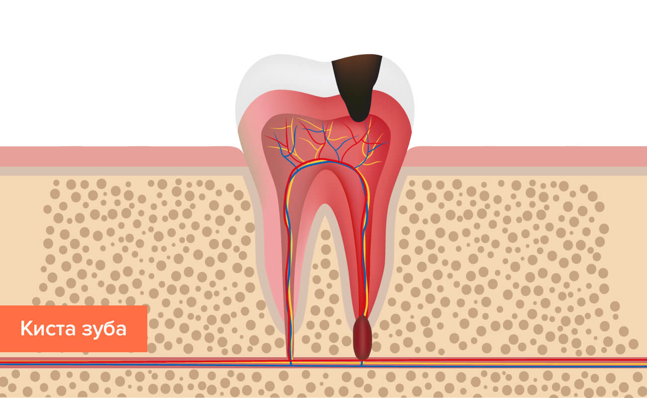 Болезни зубов и способ лечения thumbnail