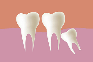 Зубы болезни и лечение thumbnail