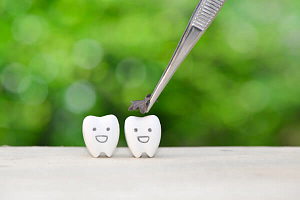 Лечение кариеса между зубов thumbnail