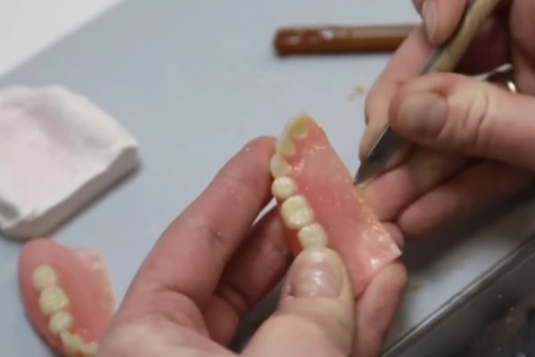 Ремонт и восстановление съемных зубных протезов (акриловых, пластмассовых, нейлоновых)