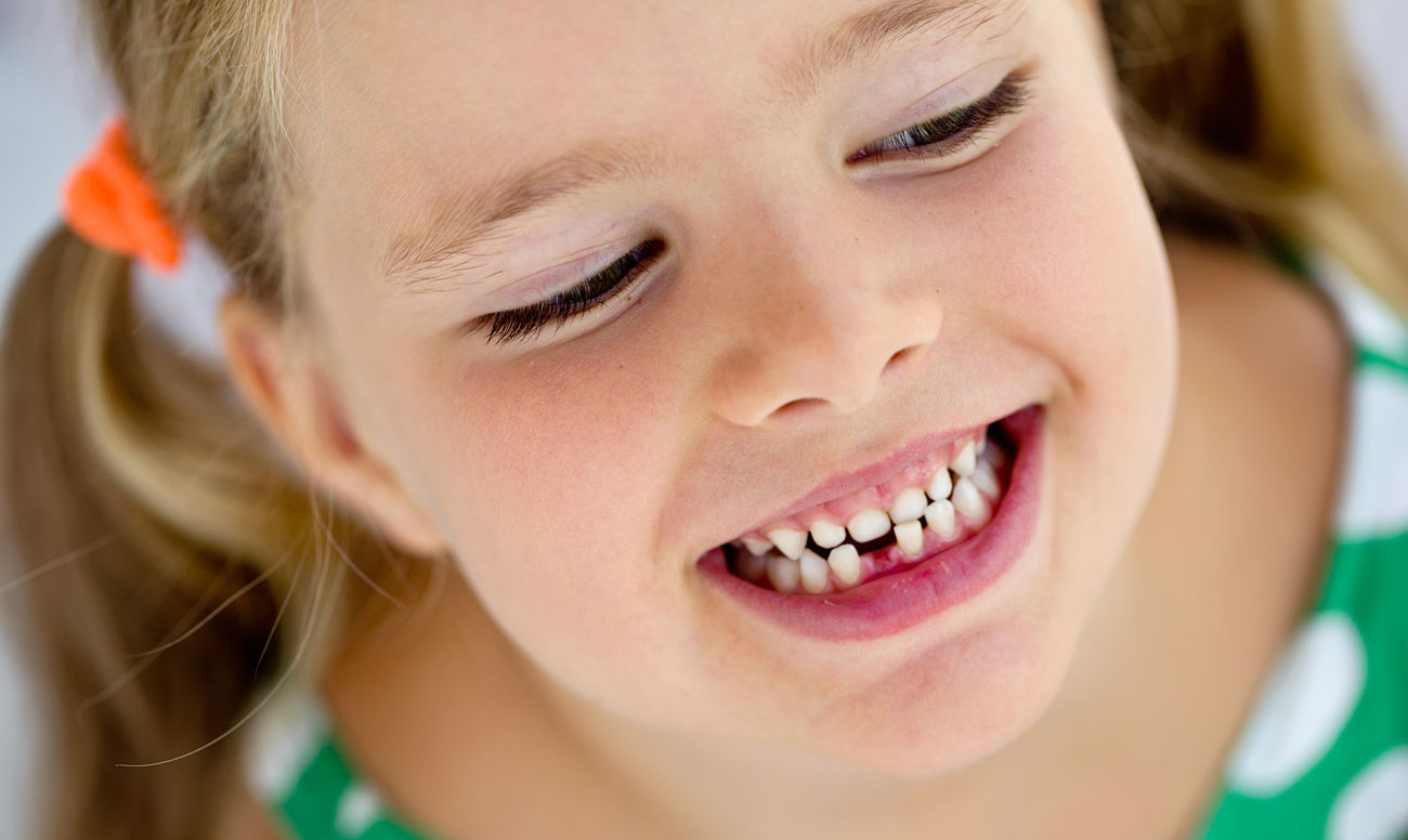 передние зубы у детей фото