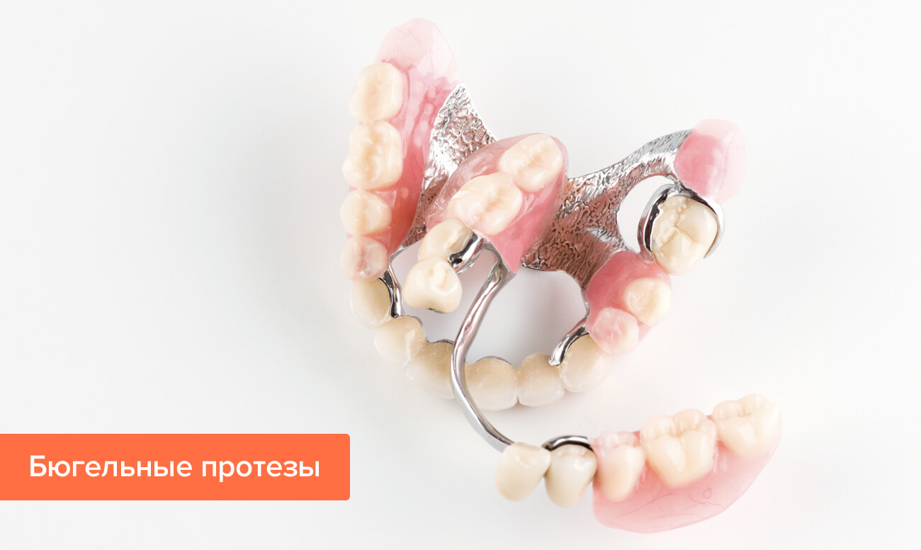 Протезы без неба – Санкт-Петербург Dental House