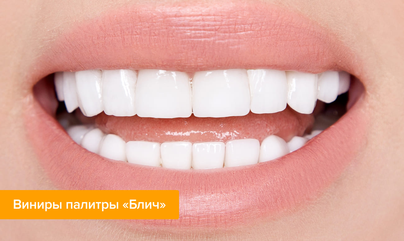 Естественный цвет зубов — особенности выбора светлого цвета