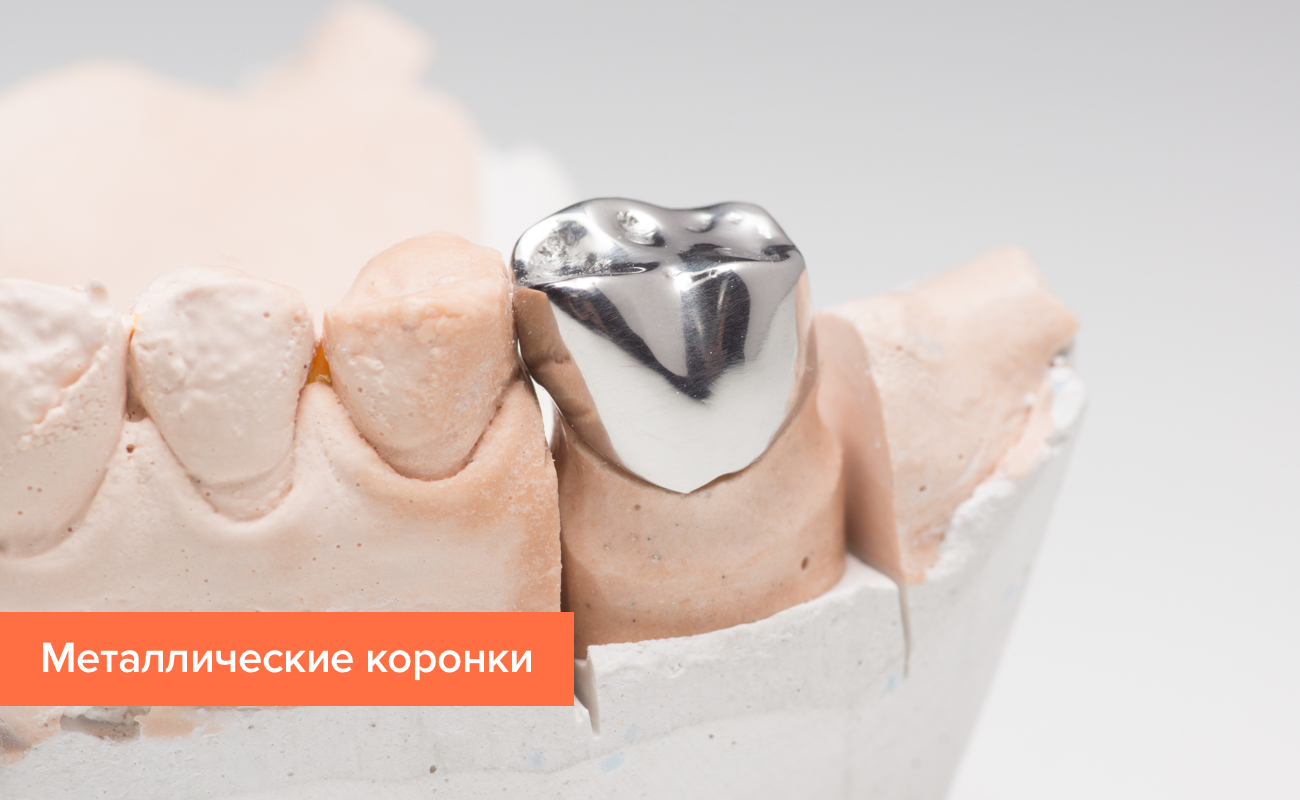 Направление зубьев на бензопиле фото