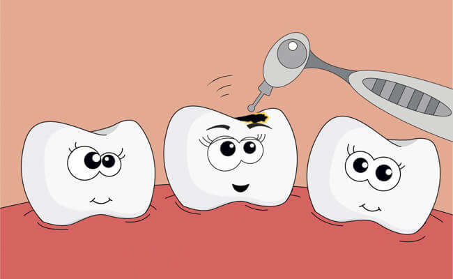 Детская стоматология – лечения зубов детям