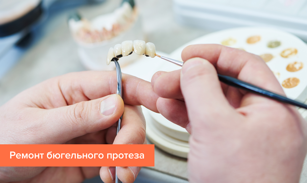 Срочный ремонт зубных протезов