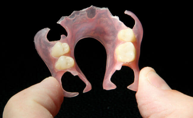 Съемные зубные протезы «бабочка»