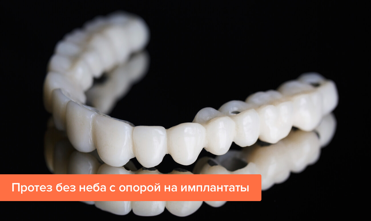 Виды съемных зубных протезов на верхнюю челюсть без неба фото