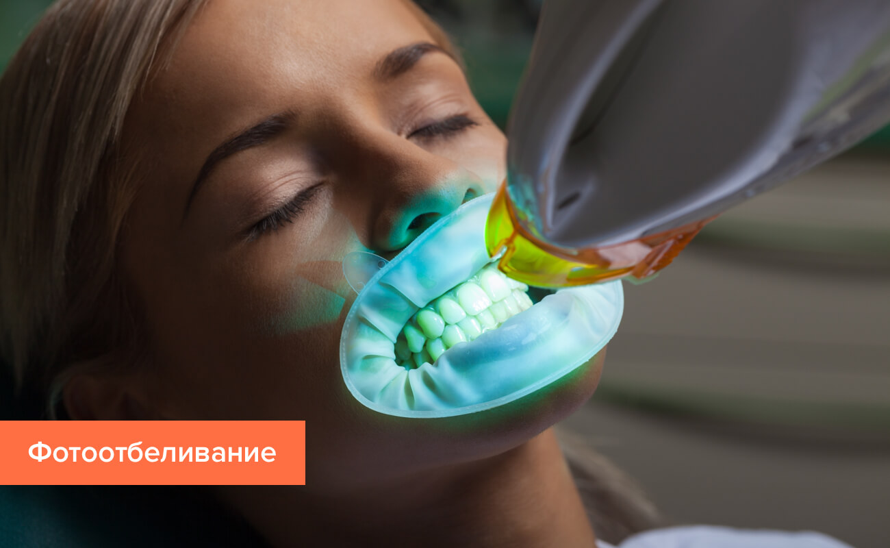 Домашнее отбеливание зубов без вреда для эмали | Stomsmile