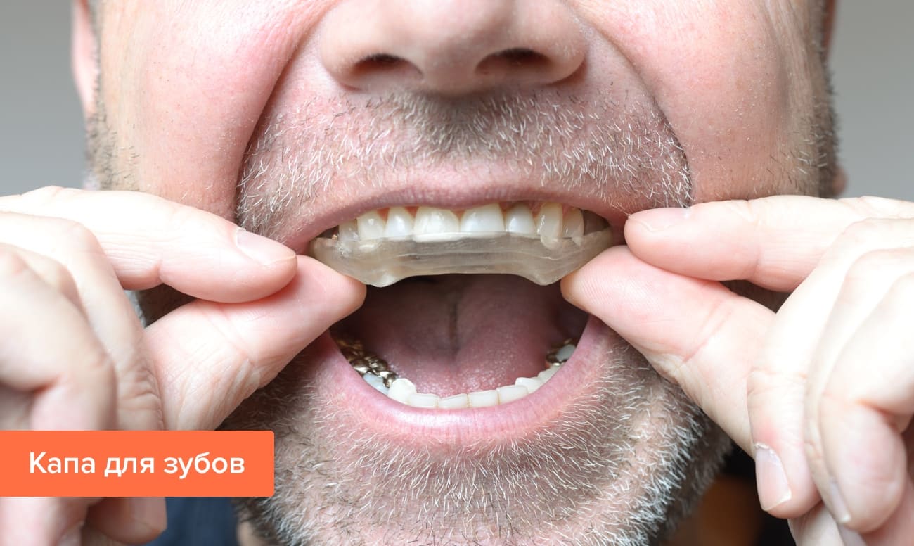 Скрежет зубов, бруксизм – причины и способы лечения
