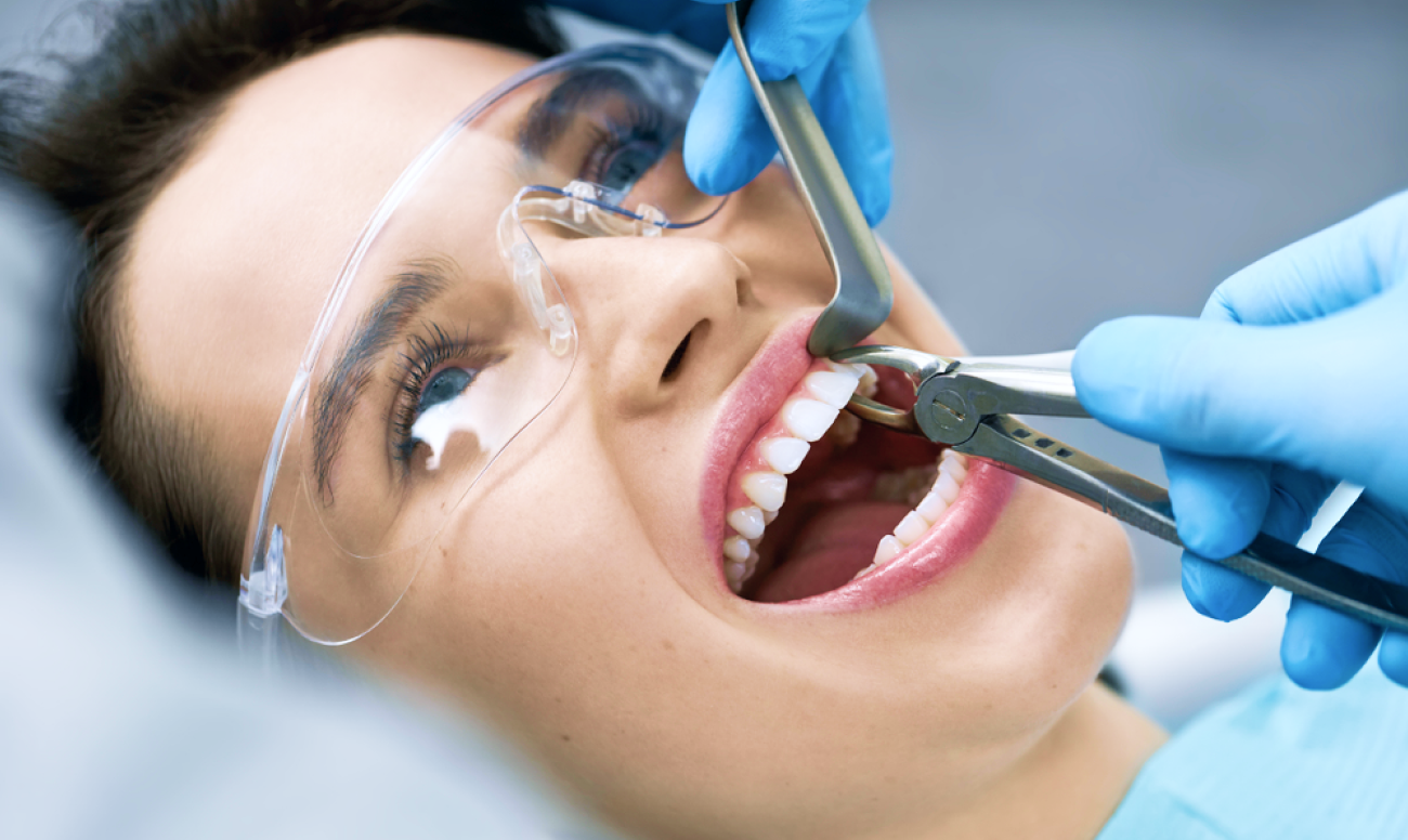 Нужно ли полоскать рот после удаления зуба