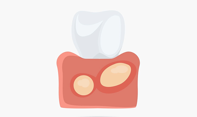 Народные средства против зубной боли | стоматологическая клиника СолоДент