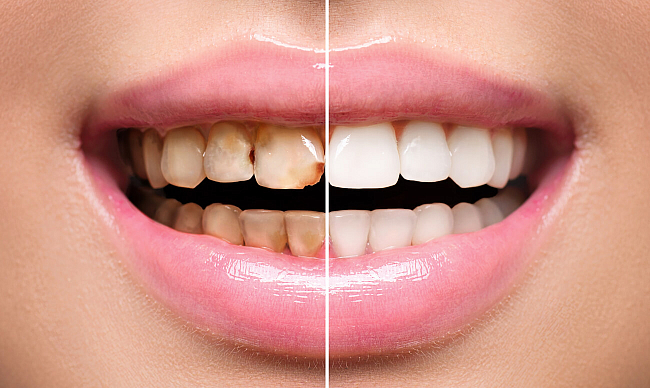 Какие проблемы решает эстетическая стоматология