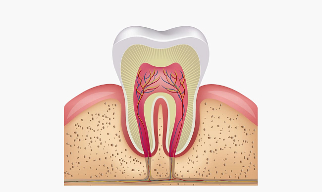 Болит зуб после удаления нерва - что делать?