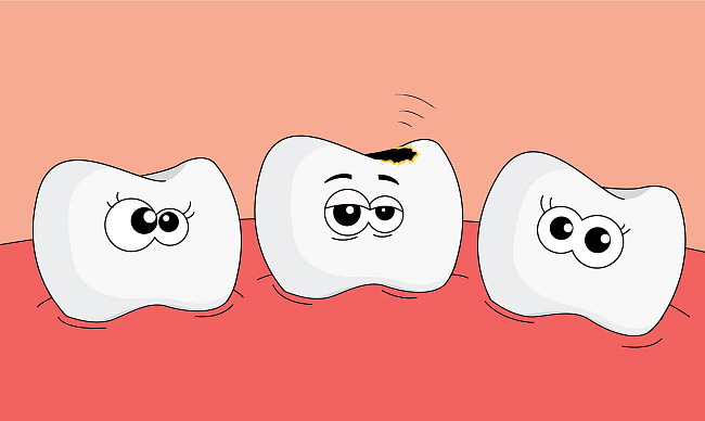 10 самых частых вопросов о лечении зубов под наркозом у детей