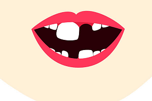 Коренные (постоянные) зубы у детей - когда появляются, меняются, схема и возраст прорезывания