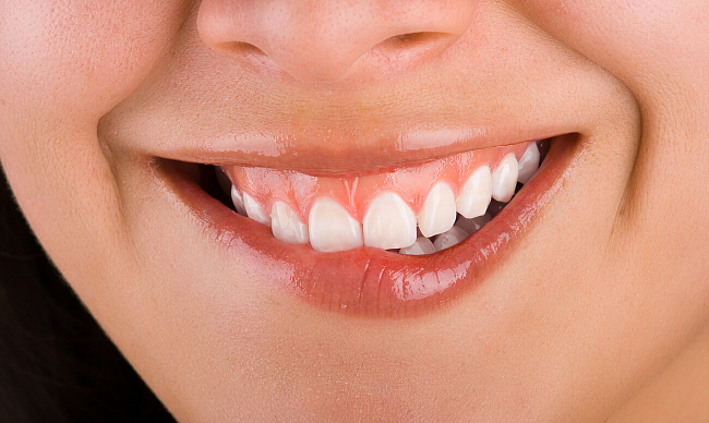 Металлокерамика или цирконий – какие зубные протезы лучше?
